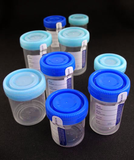 Tanner Scientific? Specimen Cups, 3oz, Temperature Strip, Orange Dual Click Lid, Sterile (400/Case)